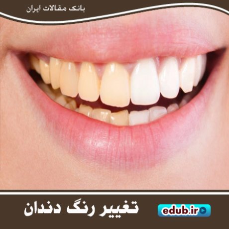 عادت‌های غلطی که باعث تغییر رنگ دندان‌ها می‌شوند