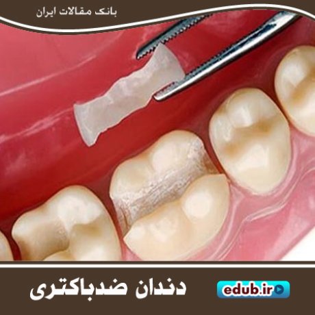 رزین‌های دندانی ضدباکتری ساخته شد